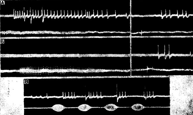 Риc. 18. Ответы восходящих слуховых интернейронов из шейных коннективов кузнечика lsophya taurica (А, Б) и сверчка Gryllus bimaculatus (В) на естественные звуковые сигналы. А - ответы тонического нейрона и детектора пульсов (импульсы большей амплитуды) на призывный (слева) и ответный (справа) сигналы; Б - ответы детектора щелчков на те же сигналы; В - ответы нейронов В и С на призывный сигнал