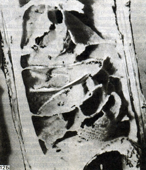  12.   Cecropia peltata   ,     Azteca (Dolichoderinae)         (). [D. J. Stradling.]
